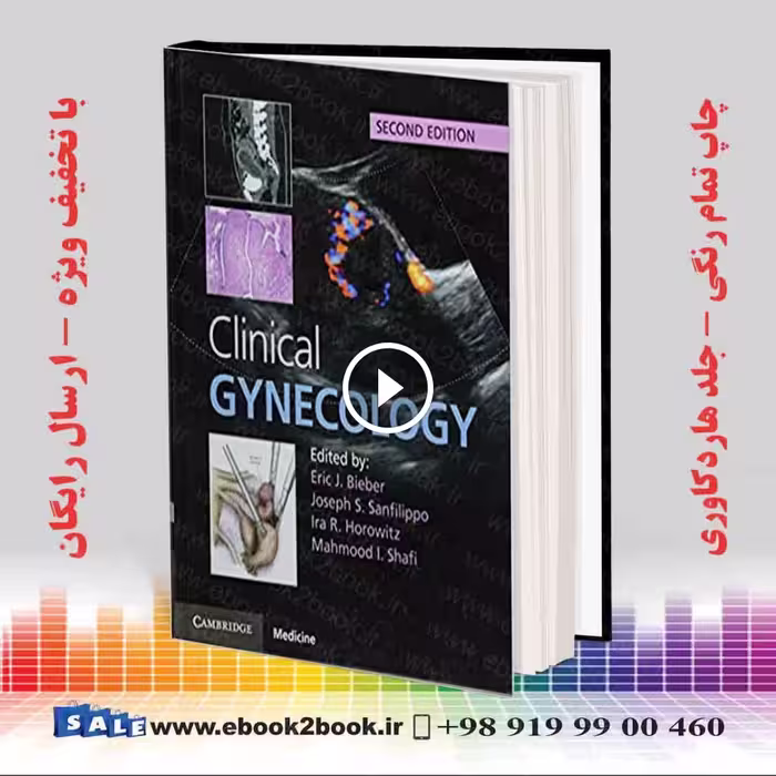 Clinical Gynecology 2nd Edition