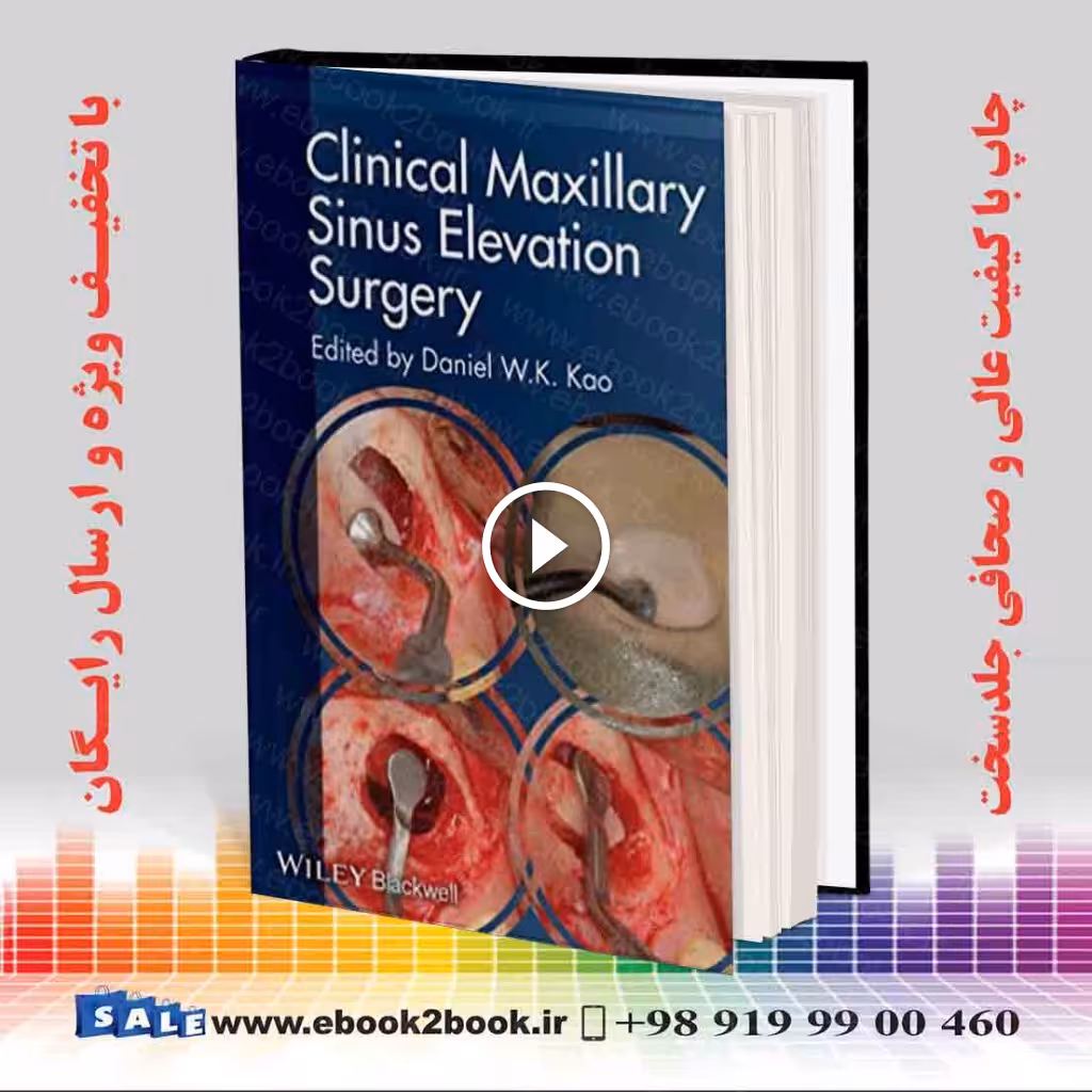 Clinical Maxillary Sinus Elevation Surgery