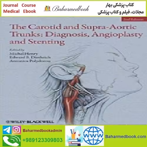 The Carotid and Supra Aortic Trunks Diagnosis Angioplasty and