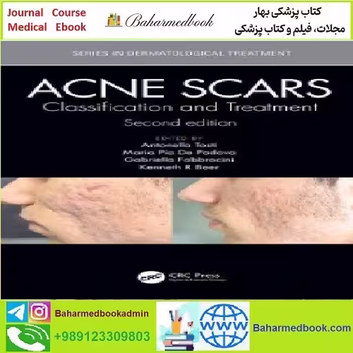 Acne Scars Classification and Treatment TRUE PDF price 1€ - کتاب پزشکی بهار