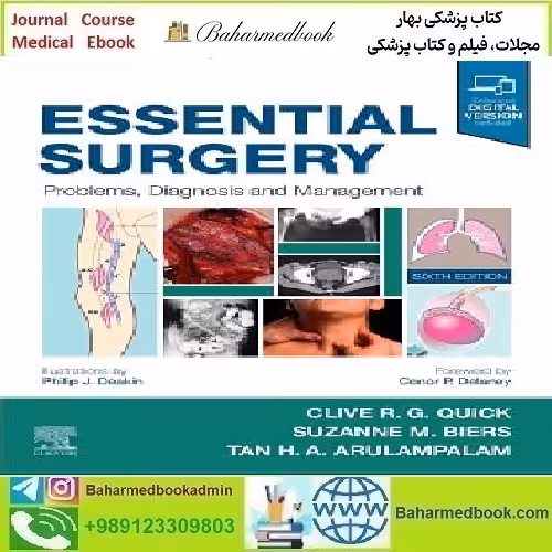 Essential Surgery Problems Diagnosis and Management 2020