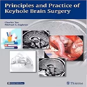 خرید و دانلود Principles and Practice of Keyhole Brain Surgery