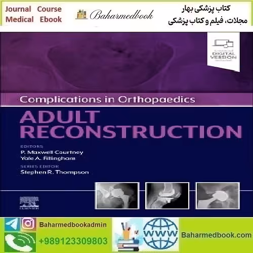 Complications in Orthopaedics Adult Reconstruction Video 2023
