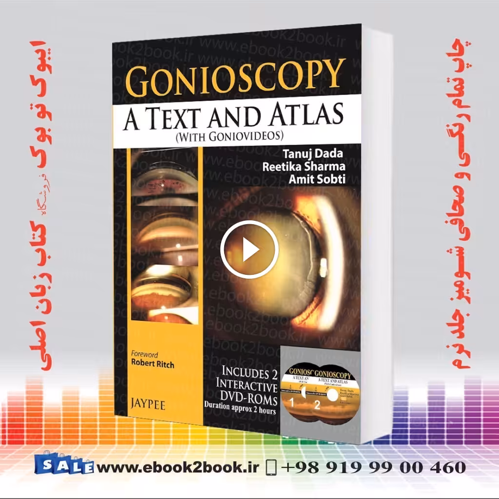 Gonioscopy: A Text and Atlas