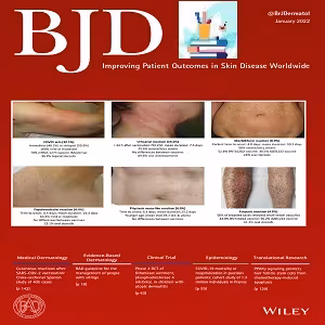 اشتراک یکساله British Journal of Dermatology 2022 Full Archives full-text pdf