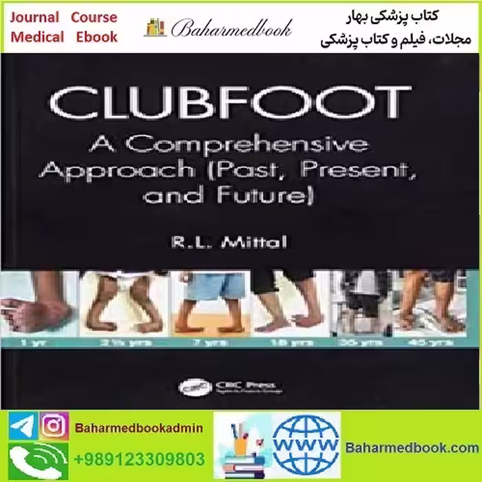 Clubfoot A Comprehensive Approach TRUE PDF price 1€ - کتاب پزشکی بهار
