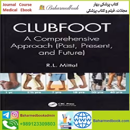 Clubfoot A Comprehensive Approach TRUE PDF price 1€ - کتاب پزشکی بهار