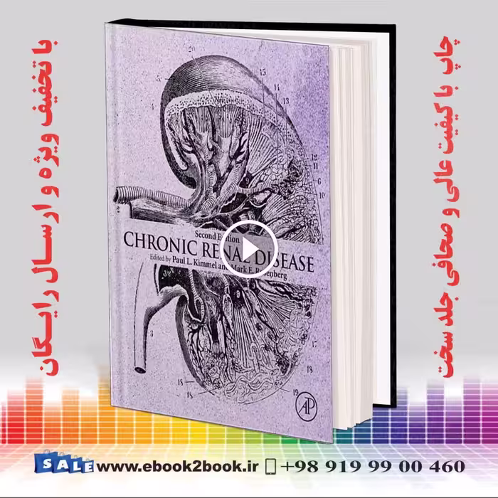 Chronic Renal Disease 2nd Edition