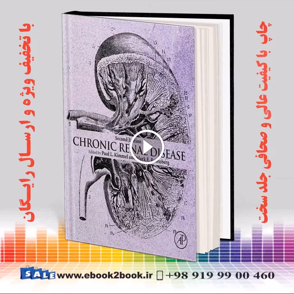 Chronic Renal Disease 2nd Edition