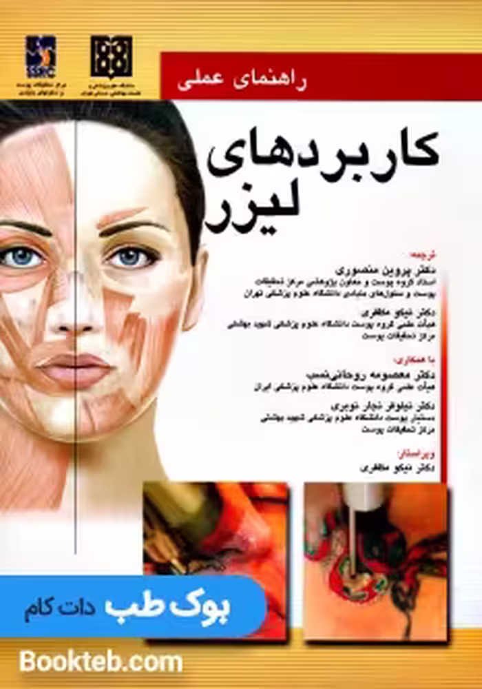 راهنمای عملی کاربردهای لیزر