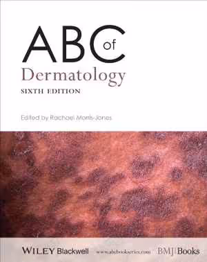 [PDF] دانلود کتاب Abc Of Dermatology, 6th ed, 2014
