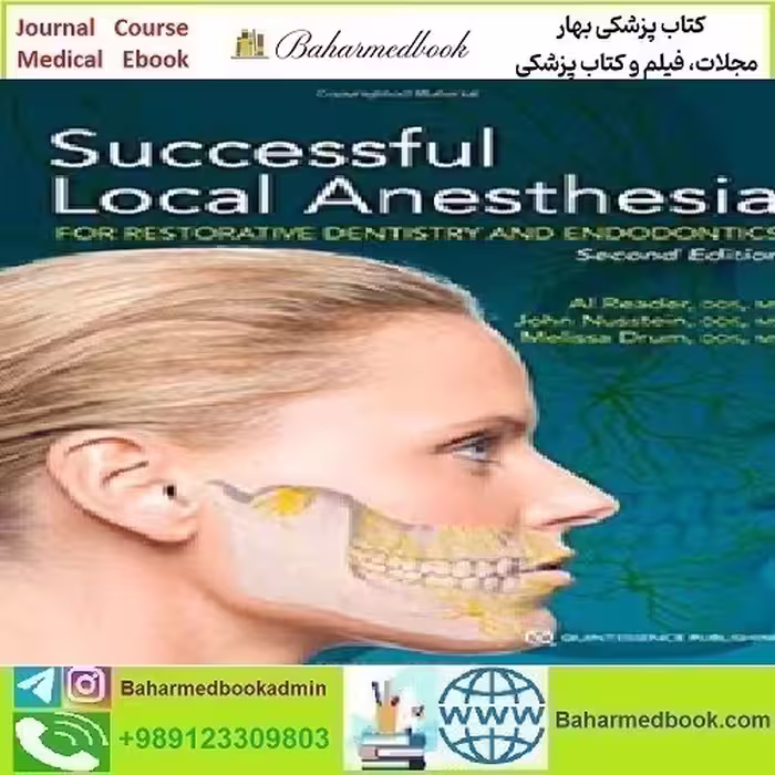 Successful Local Anesthesia for Restorative Dentistry and E