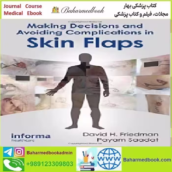 Making Decisions and Avoiding Complications in Skin Flaps TRU