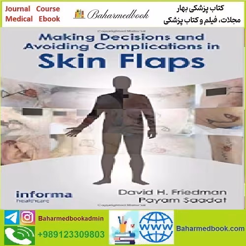 Making Decisions and Avoiding Complications in Skin Flaps TRU