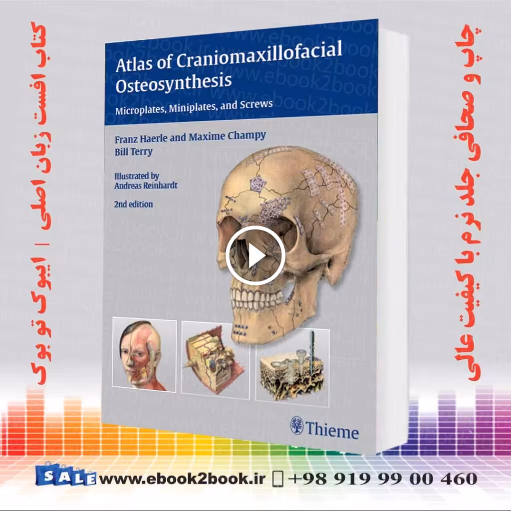 Atlas of Craniomaxillofacial Osteosynthesis 2nd Edition
