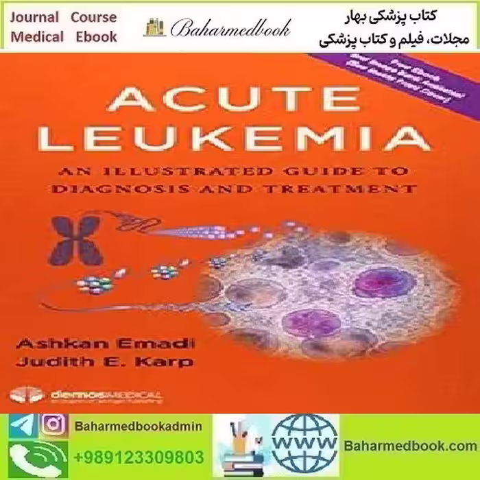 Acute Leukemia An Illustrated Guide to Diagnosis and Treatment