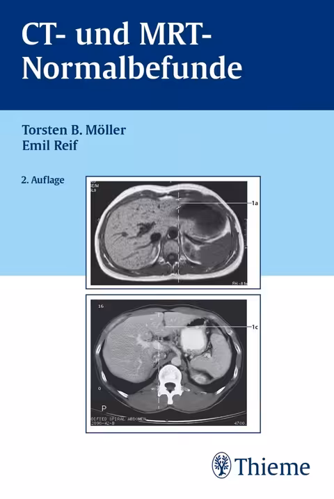 خرید و دانلود نسخه کامل کتاب CT und MRT Normalbefunde - Pdf