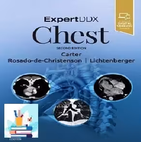 ExpertDDxExpertDDx Chest Convertef PDF price 1€