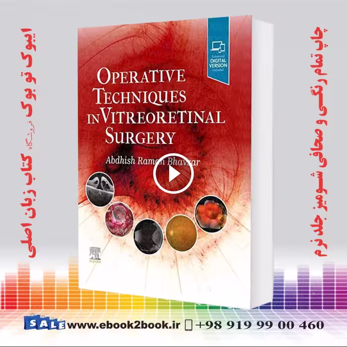 Operative Techniques in Vitreoretinal Surgery