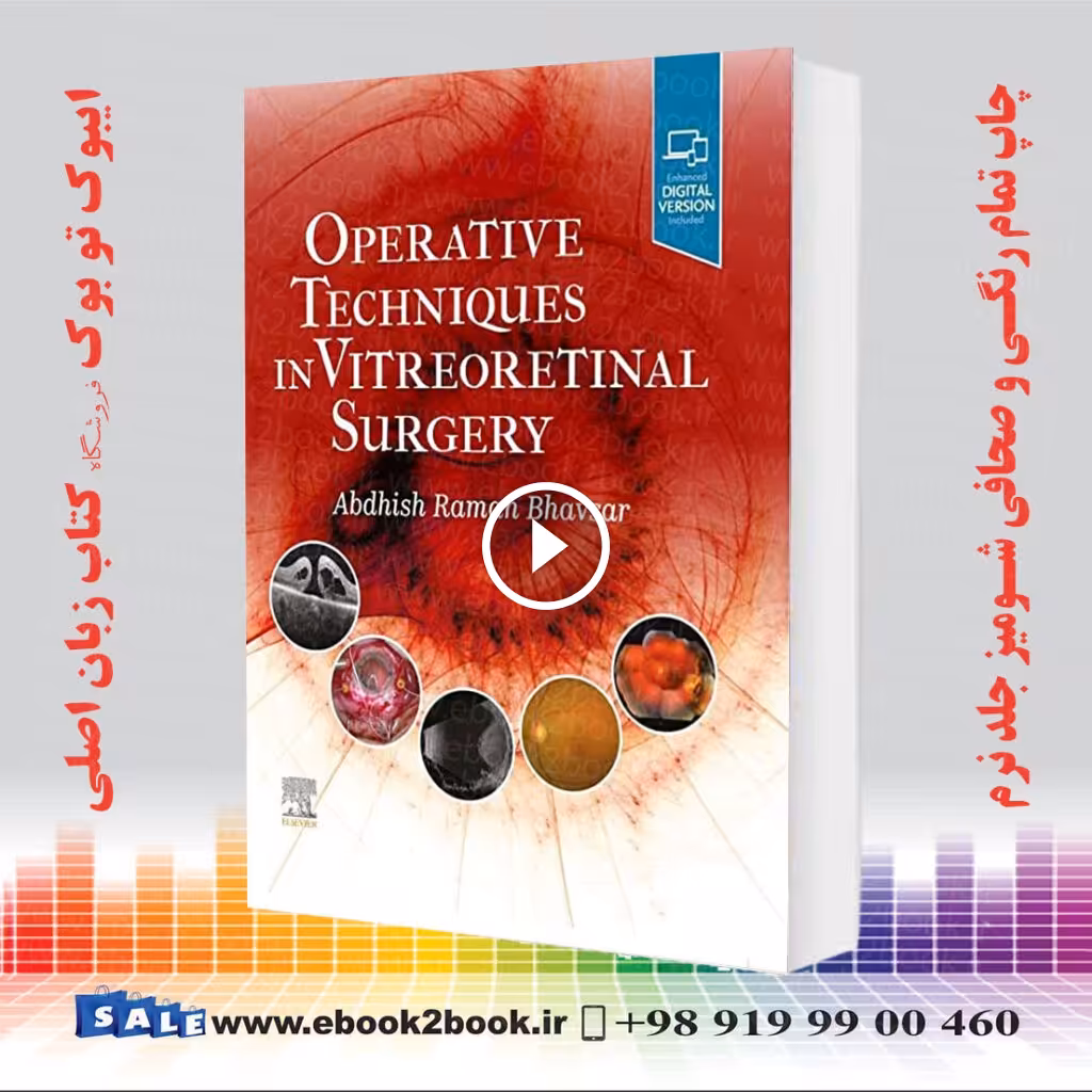 Operative Techniques in Vitreoretinal Surgery