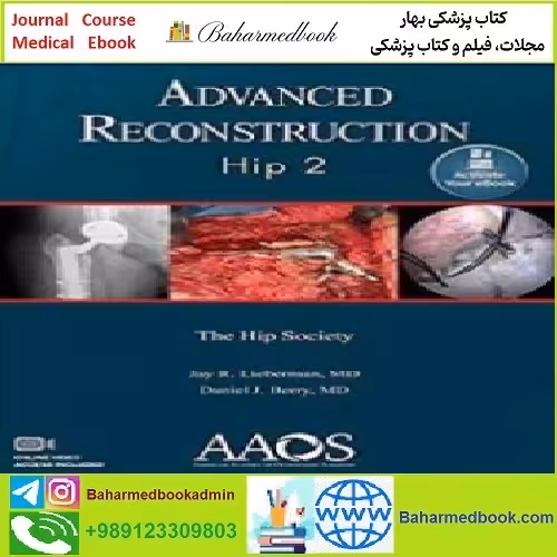 Advanced Reconstruction TRUE PDF price 1€ - کتاب پزشکی بهار