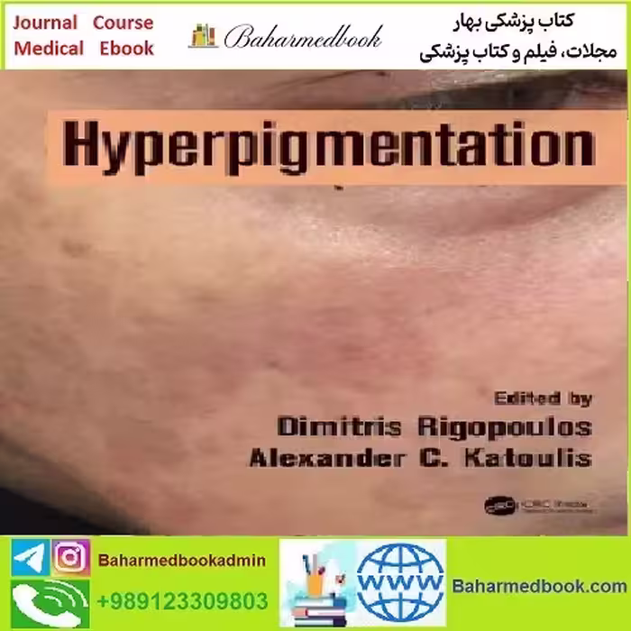 Hyperpigmentation TRUE PDF price 1€ - کتاب پزشکی بهار