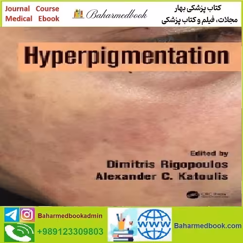 Hyperpigmentation TRUE PDF price 1€ - کتاب پزشکی بهار