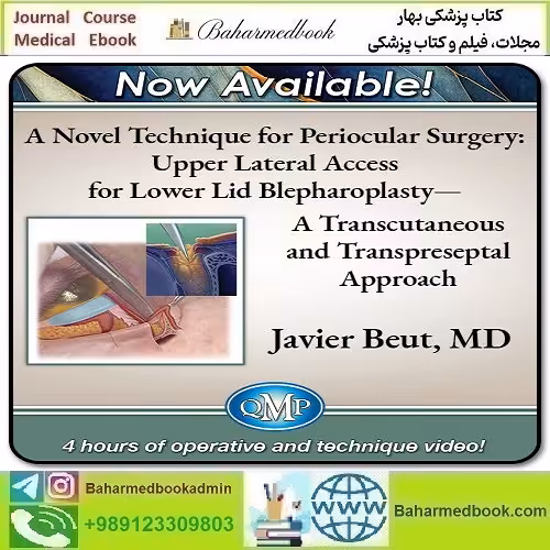 A Novel Technique for Periocular Surgery Upper Lateral Access for