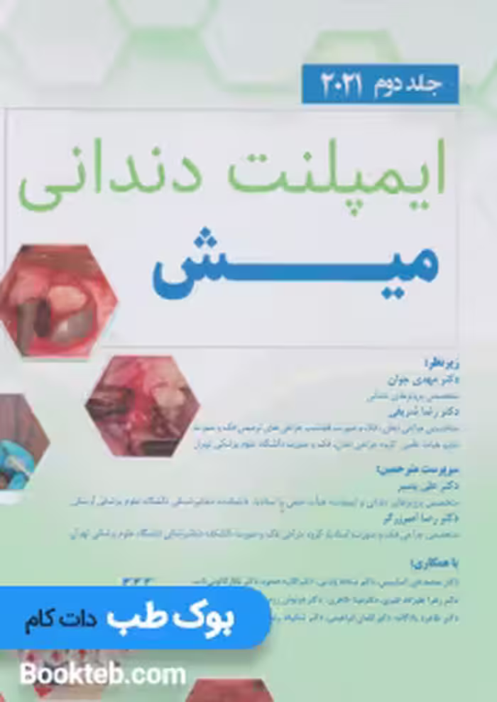 ایمپلنت دندانی میش 2021 جلد دوم