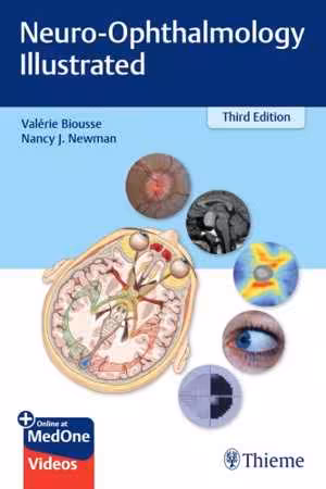 [PDF] دانلود کتاب Neuro-Ophthalmology Illustrated, 3rd ed, 2019