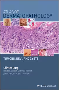 Atlas of Dermatopathology: Tumors, Nevi, and Cysts 2019, - کتاب پزشکی بهار