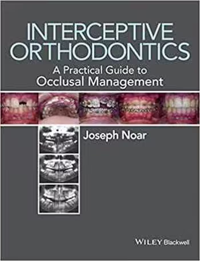 [PDF] دانلود کتاب Interceptive Orthodontics - A Practical Guide To Occlusal Management, 2014