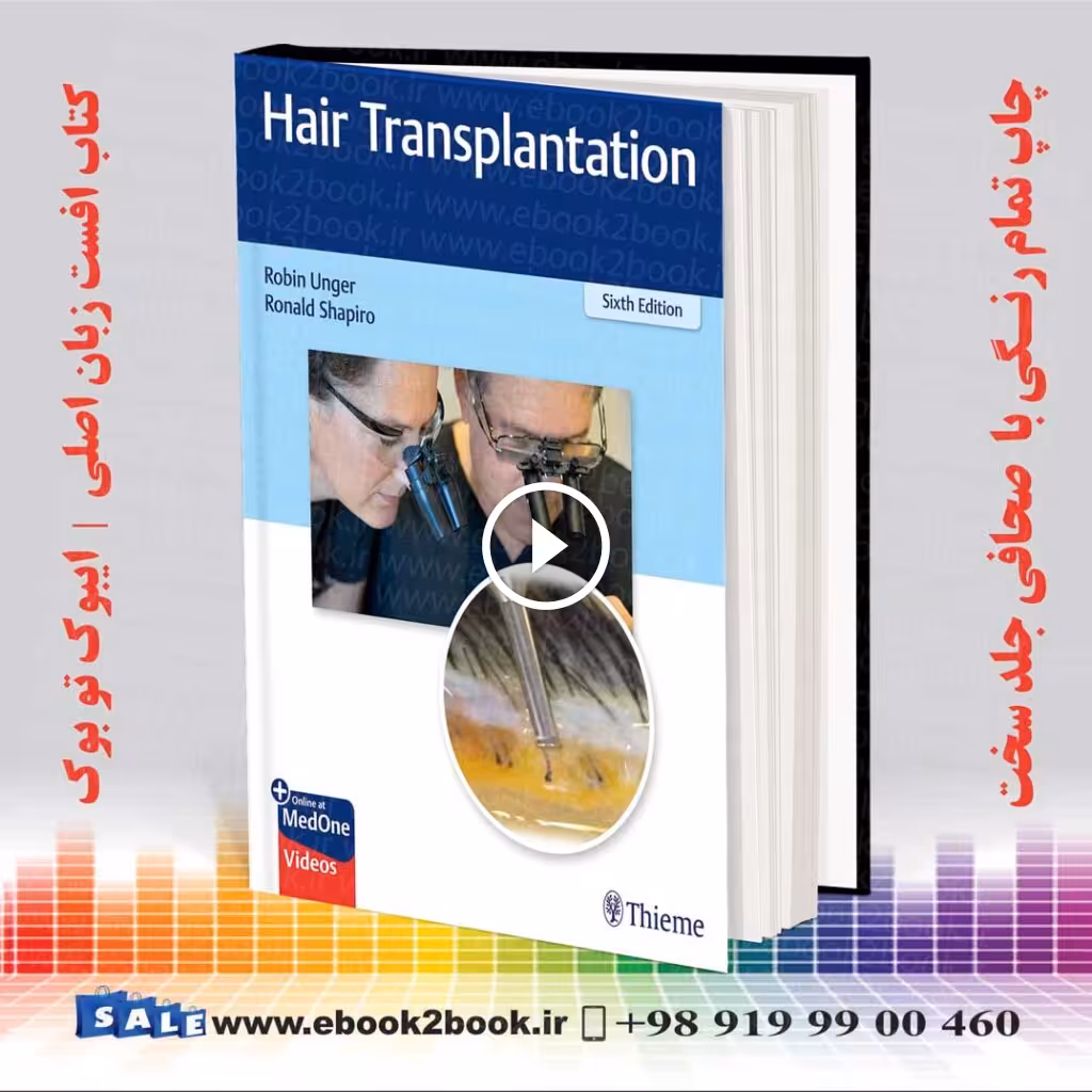 Hair Transplantation 6th Edition