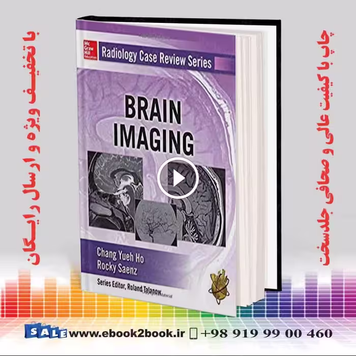Radiology Case Review Series: Brain Imaging