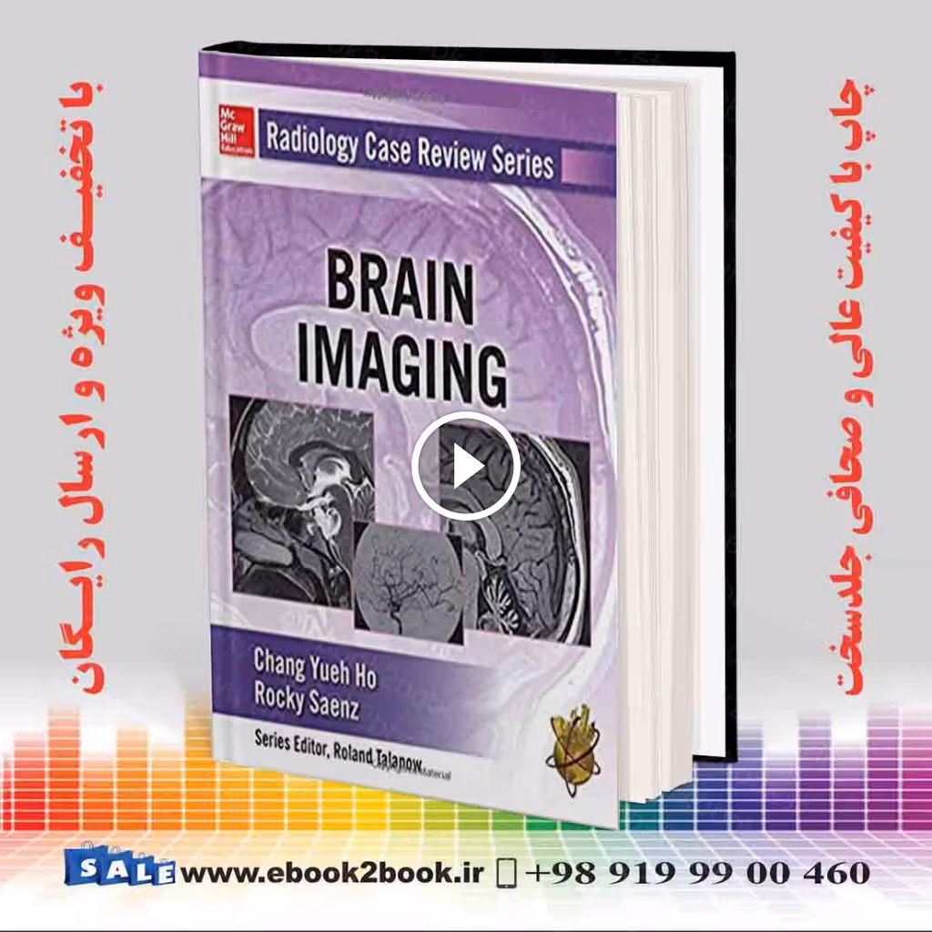 Radiology Case Review Series: Brain Imaging