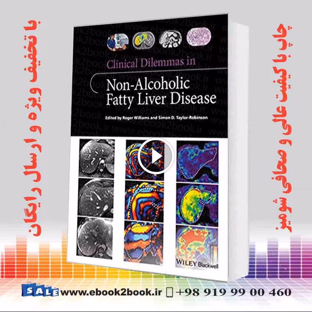 Clinical Dilemmas in Non-Alcoholic Fatty Liver Disease