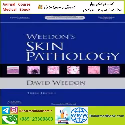 Weedon's Skin Pathology Expert Consult TRUE PDF price 1€ - کتاب پزشکی بهار
