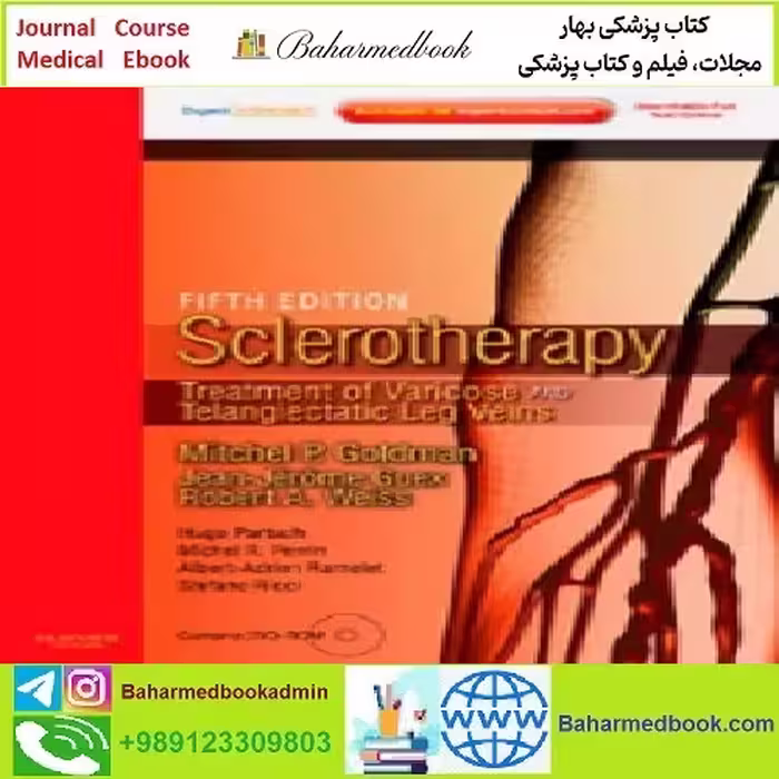 Sclerotherapy Treatment of Varicose and Telangiectatic Leg Veins