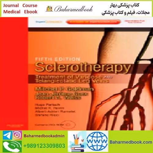 Sclerotherapy Treatment of Varicose and Telangiectatic Leg Veins