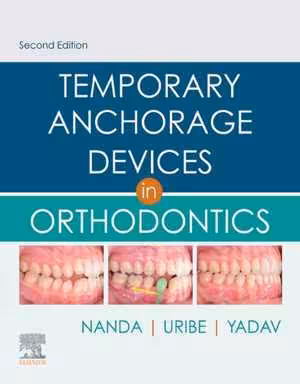 [PDF] دانلود کتاب Temporary Anchorage Devices In Orthodontics, 2nd ed, 2020