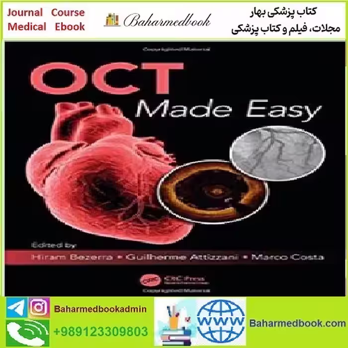 OCT Made Easy TRUE PDF price 1€ - کتاب پزشکی بهار
