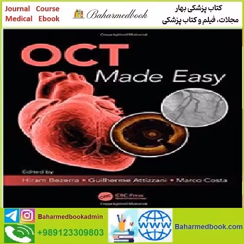OCT Made Easy TRUE PDF price 1€ - کتاب پزشکی بهار