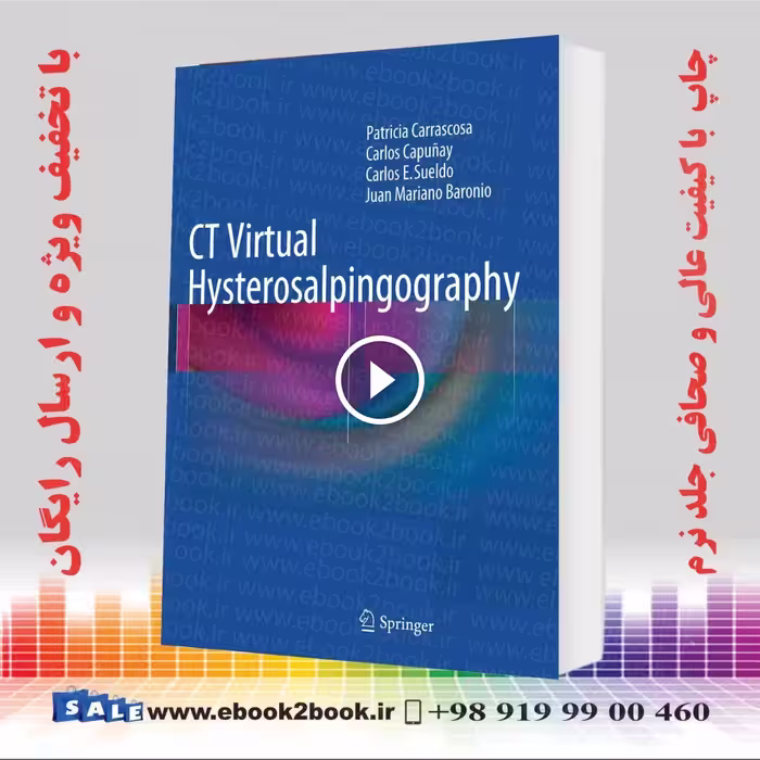 CT Virtual Hysterosalpingography