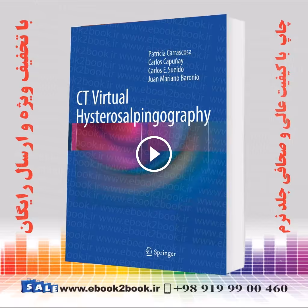 CT Virtual Hysterosalpingography