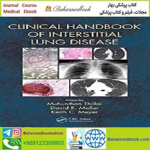 Clinical Handbook of Interstitial Lung Disease TRUE PDF price 1€ - کتاب پزشکی بهار
