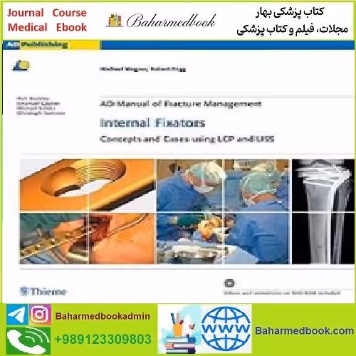 AO Manual of Fracture Management Internal Fixators TRUE P