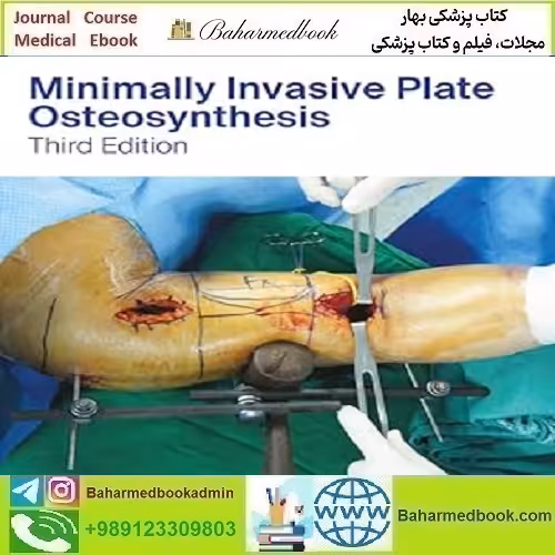Minimally Invasive Plate Osteosynthesis 2022 دانلود کتاب الکترونیکی