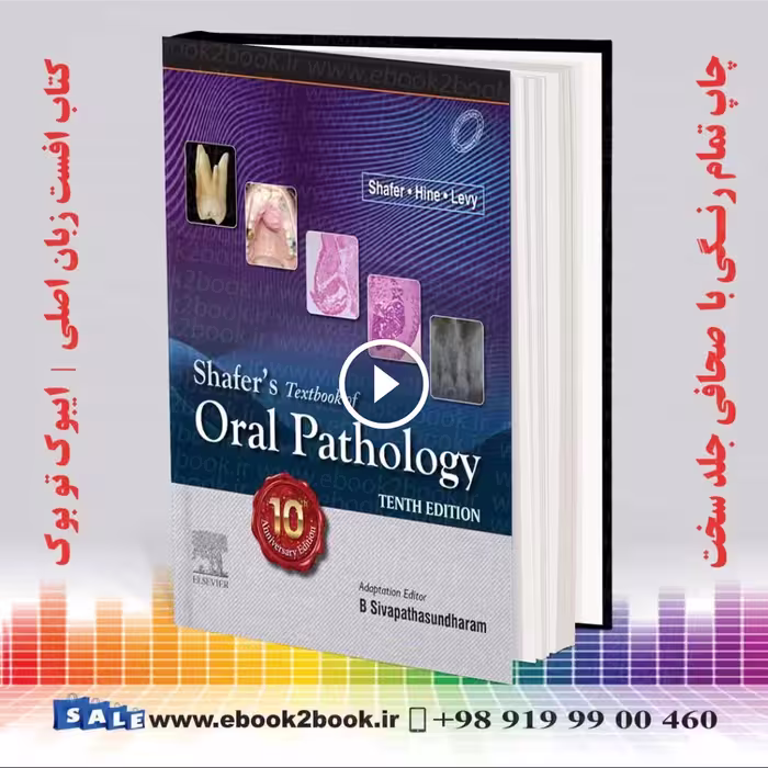 Shafers Textbook of Oral Pathology