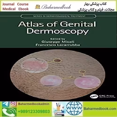 Atlas of Genital Dermoscopy TRUE PDF price 1€ - کتاب پزشکی بهار