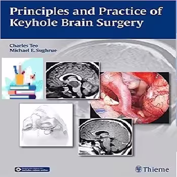 Principles and Practice of Keyhole Brain Surgery 1ed PDF Video at 2€ - کتاب پزشکی بهار
